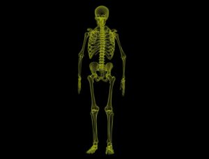 radiculopathy